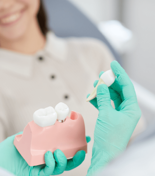 Wisdom Tooth Extraction Airdrie